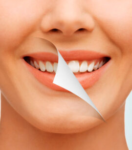 clareamento dental